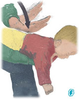 Maniobra de Heimlich: golpes en la espalda