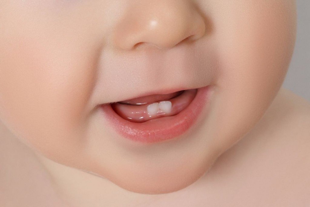 la caries dental en los bebés