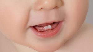 dolor de la dentición del bebé