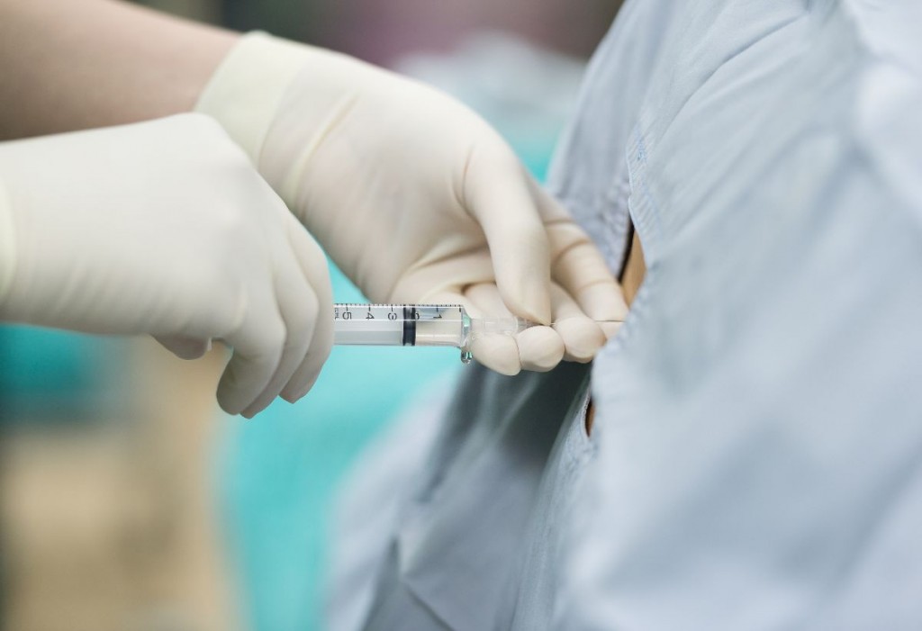 diferencias entre la anestesia epidural y la raquídea