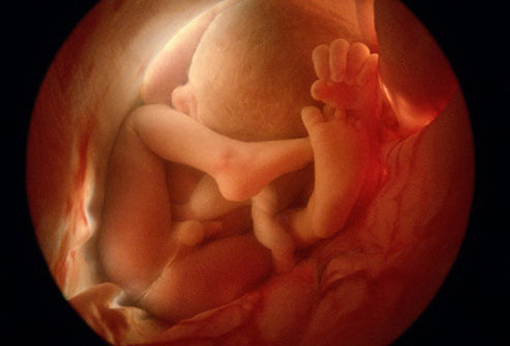 fecundación in vitro