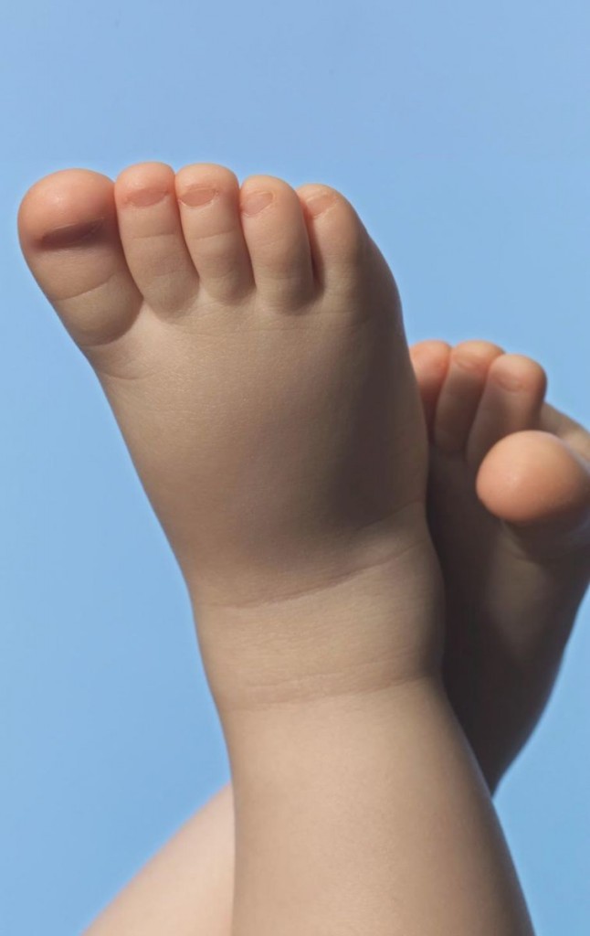 Qué hacer si el bebé tiene Eczemas