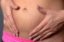 diástasis de los rectos abdominales