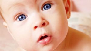 Niños con albinismo ¿cómo los afecta?