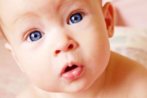 Niños con albinismo ¿cómo los afecta?
