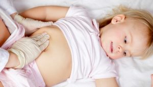 Diferencias entre apendicitis y peritonitis