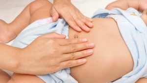 Hernia epigástrica en los niños