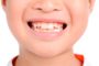 dientes de los niños