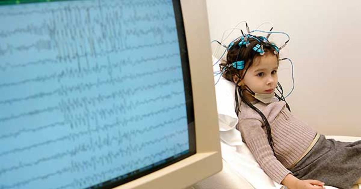 La epilepsia es una enfermedad que afecta a los niños