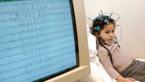 La epilepsia es una enfermedad que afecta a los niños