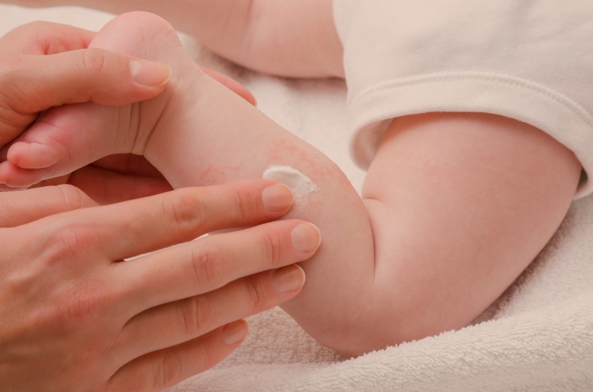 La dermatitis es una enfermedad cutánea